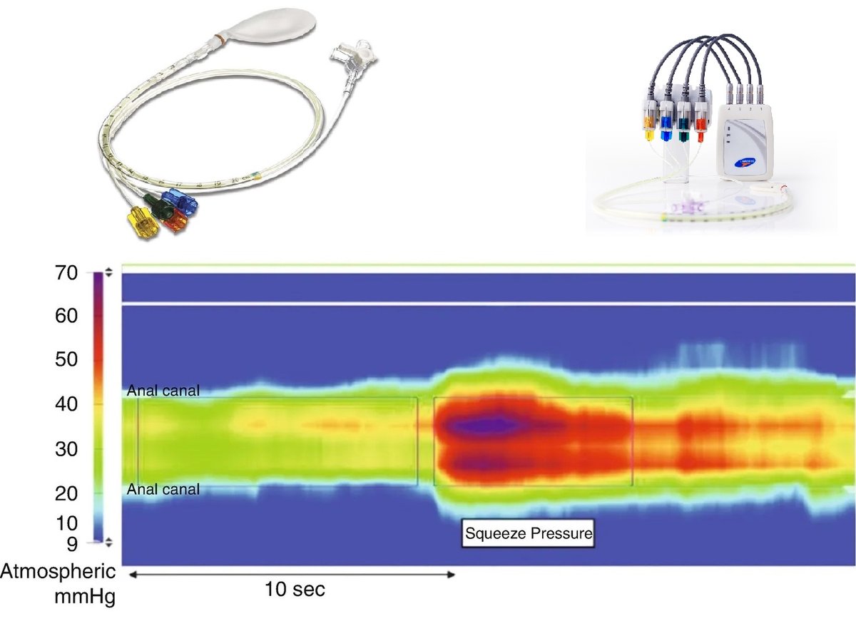 A Review of Anorectal Manometry Equipment Makers