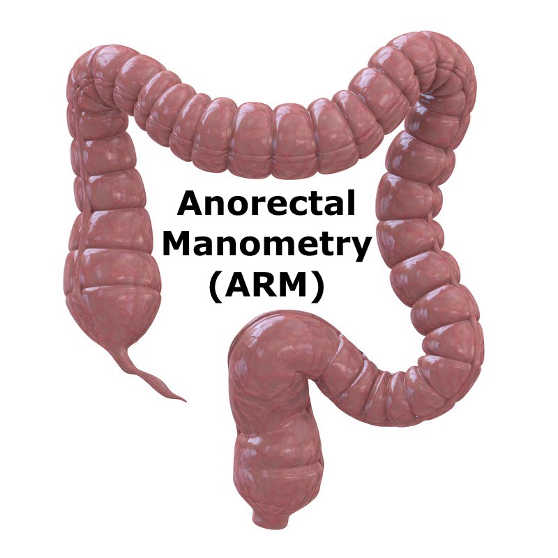 How To Interpret Conventional Anorectal Manometry