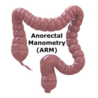 Anorectal Manometry