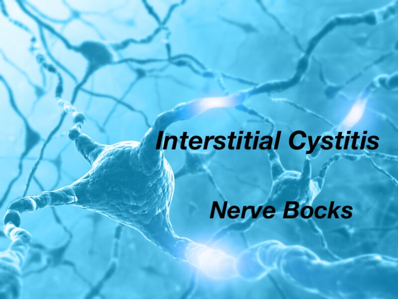 research-summary-interstitial-cystitis-response-and-nerve-blocks