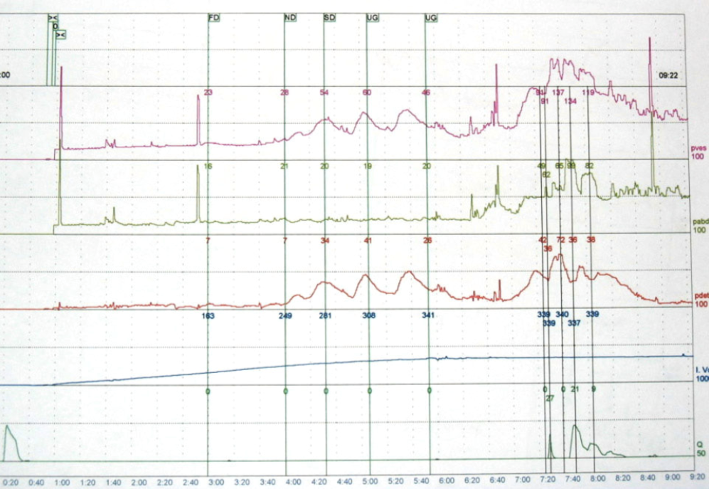 UDSFigure1